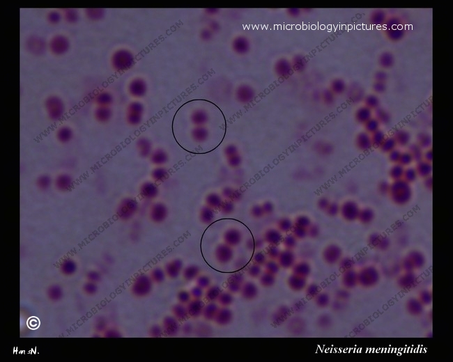 Neisseria Gram Stain